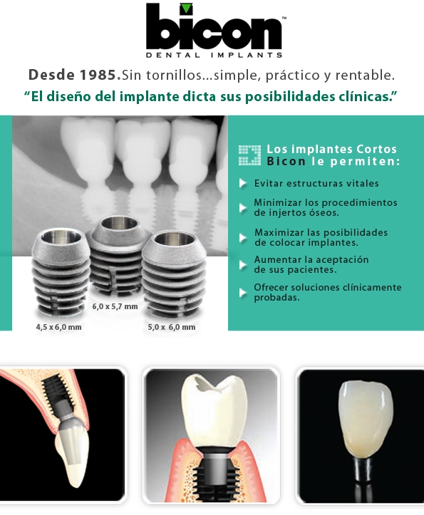 implante_dental_bicon_puerto_madero_odontologo