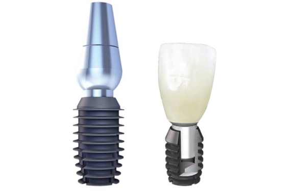 Implantes dentales